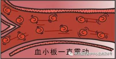 血小板是正常值的三倍？專(zhuān)家提醒小心血栓和出血！
