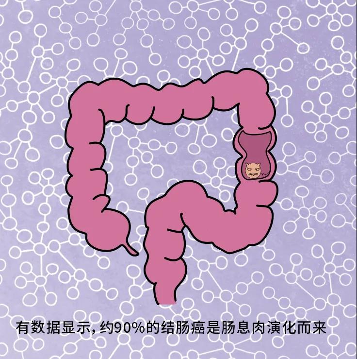 奪走“黑豹”生命的結(jié)腸癌，到底什么來頭？