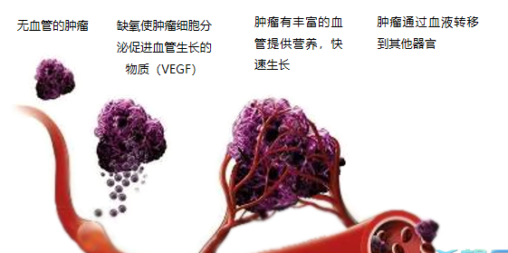 晚期腫瘤為什么會復發(fā)轉(zhuǎn)移？