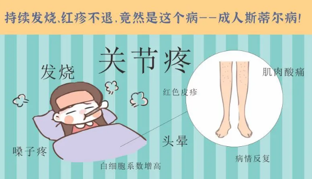 持續(xù)發(fā)燒、紅疹不退……她終于在這里治好了這個罕見病