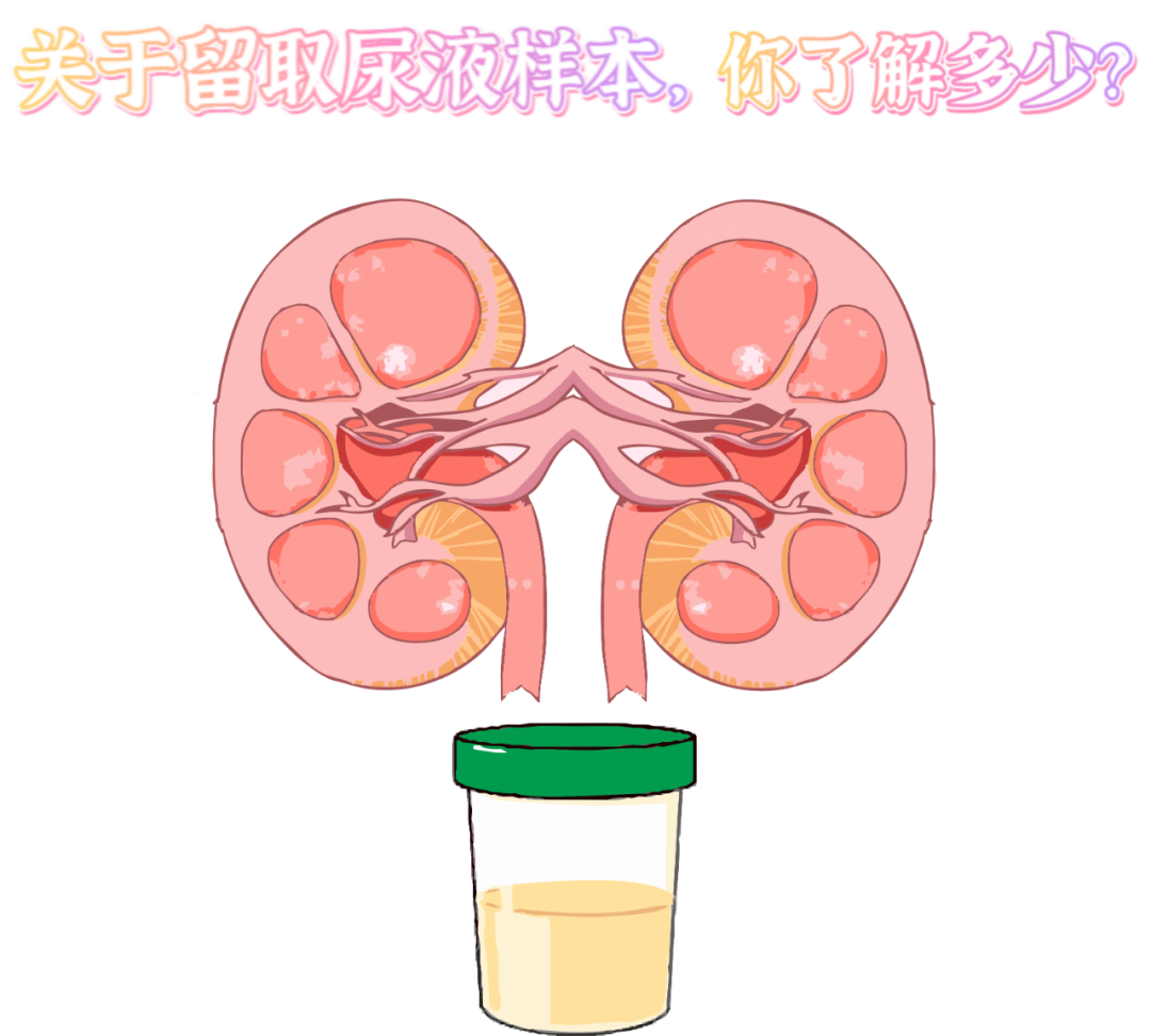 做尿檢，不得不說的注意事項！