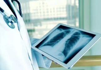 健康呼吸④體檢發(fā)現(xiàn)肺結(jié)節(jié)，我該怎么辦？