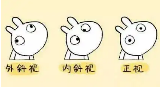 小baby老歪著頭？警惕斜頸! 這樣糾正……