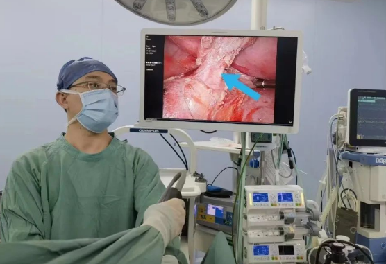 30歲小伙持續(xù)發(fā)燒咳嗽，原來是多長(zhǎng)一塊肺......