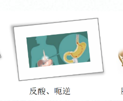 關(guān)愛身體健康，輕松檢查胃腸