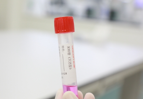 支原體感染檢測(cè)手段知多少？