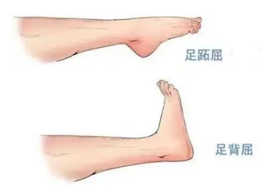 扭胯小連步、動感搖花手……“科目三”雖火，運動損傷也要防！