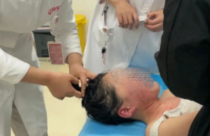 14歲，面、頸、胸燙傷，只因中午那鍋面湯…